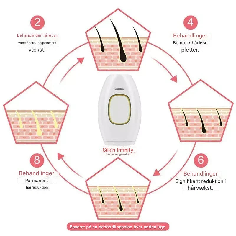 GlowSilk IPL Hårfjerningsapparat – Glat hud derhjemme